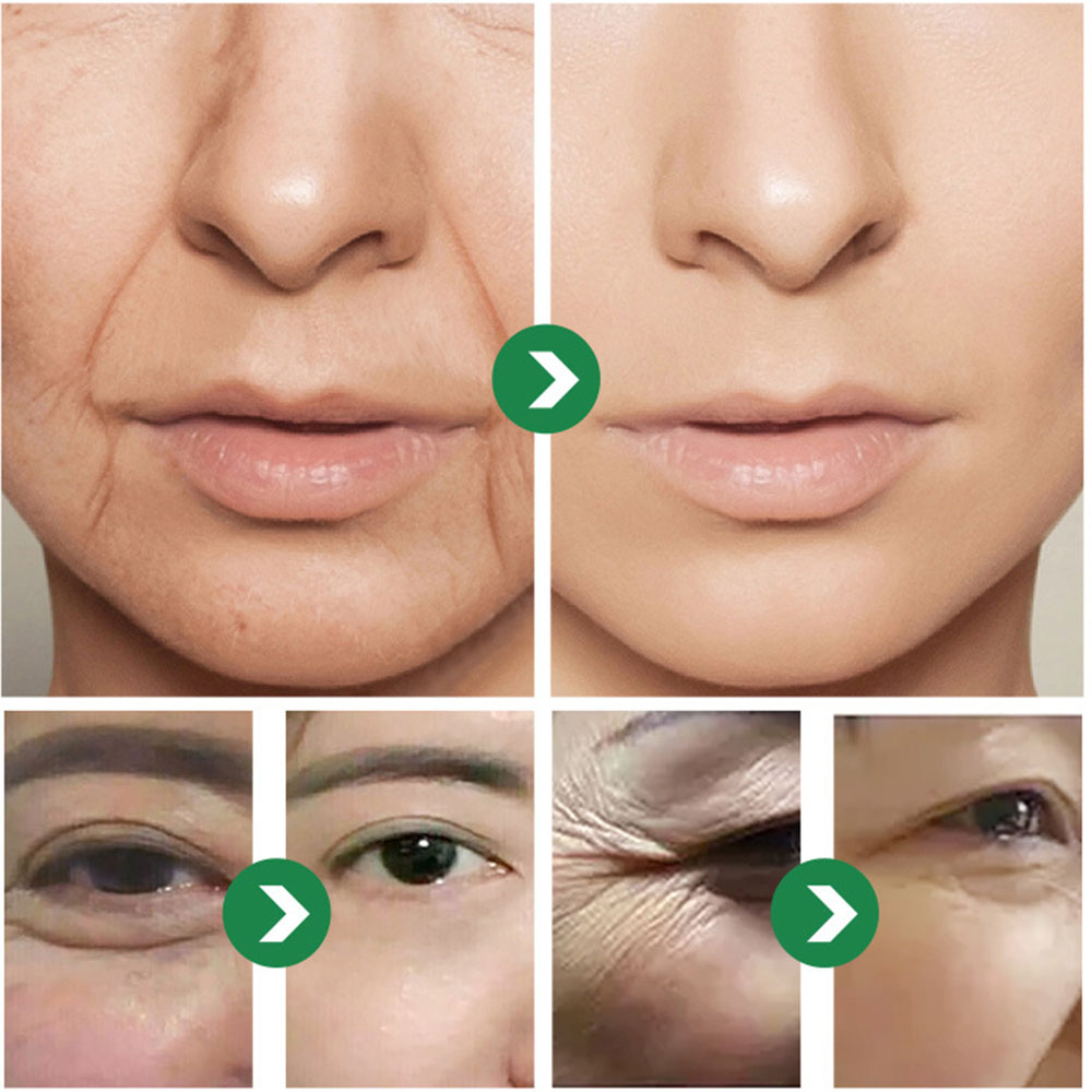 50g Japanese Six peptides Crea - огляд і ціна Eye Cream Peptide